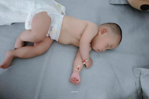 曹县六个月宝宝眼睛散光
